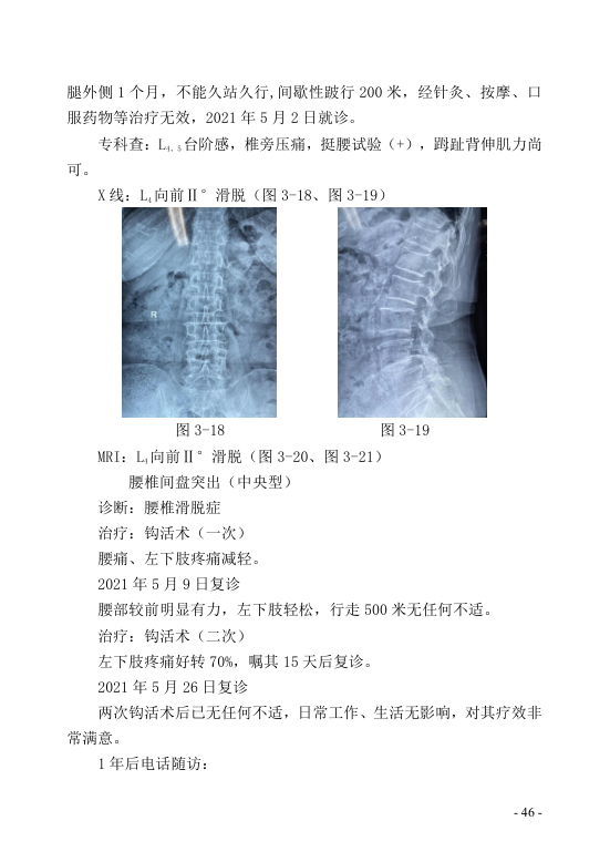 中医钩活术技术(自出）转出第57页.jpg