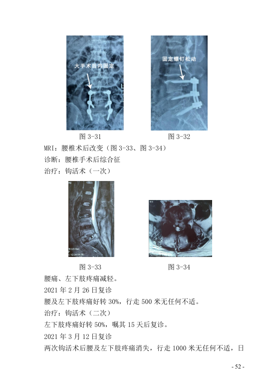 中医钩活术技术(自出）转出第63页.jpg