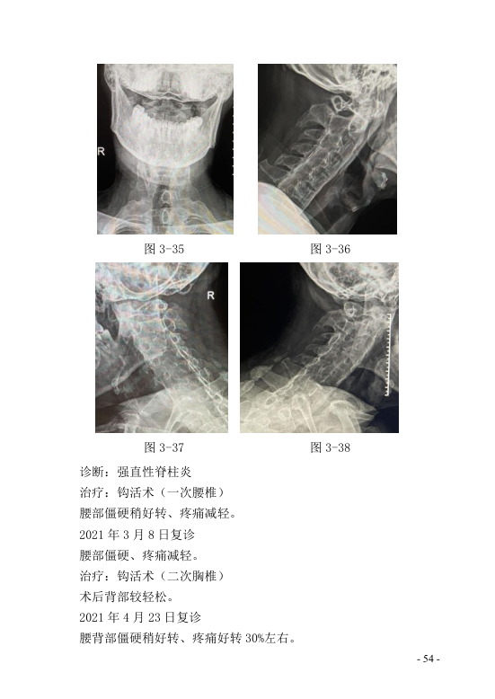 中医钩活术技术(自出）转出第65页.jpg