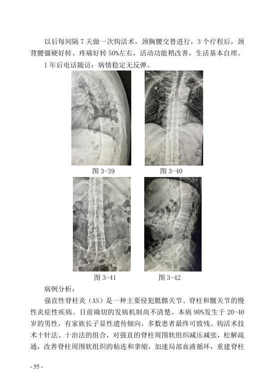 中医钩活术技术(自出）转出第66页.jpg