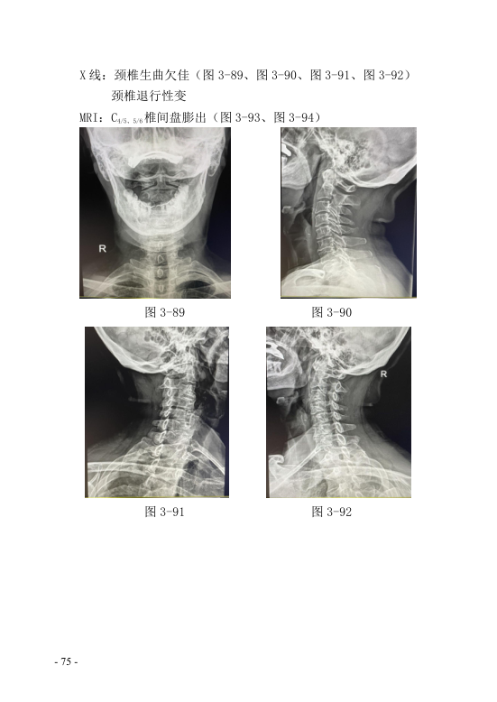 中医钩活术技术(自出）转出第86页.jpg