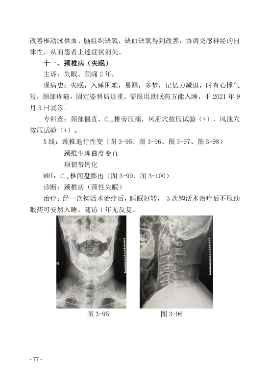 中医钩活术技术(自出）转出第88页.jpg