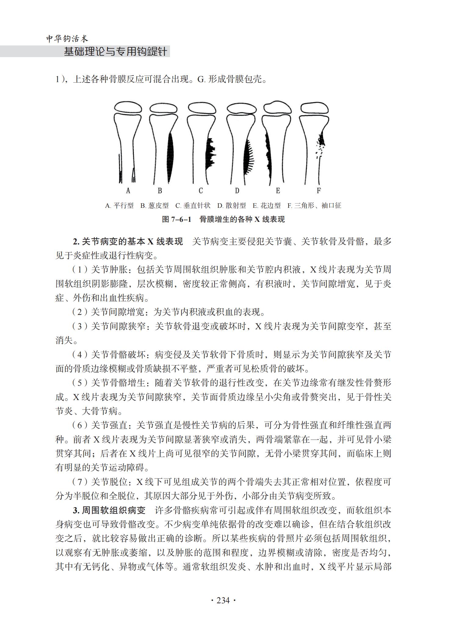 中华钩活术基础理论与专用钩鍉针-4J-2022-1-14_249.jpg